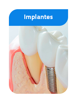 implantes