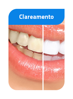 clareamento-min